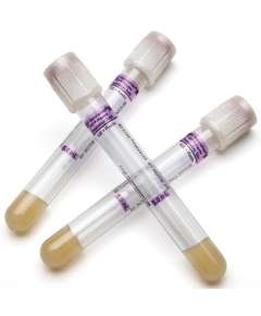 BD 5ml K2 EDTA 100Pack Plasma Preparation Vacutainer Tubes