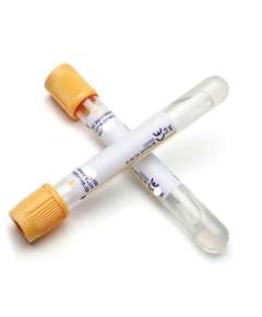 BD SST II Advance Yellow Top 100Pack Vacutainer Tubes, Draw Volume: 8.5ml