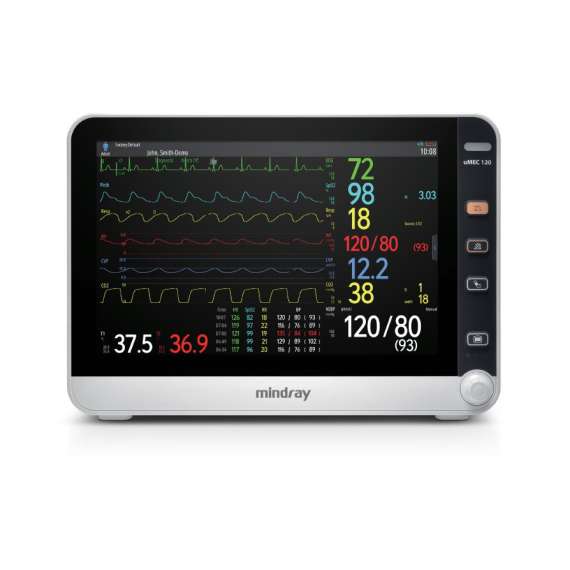 Mindray UMEC 100 5Parameter Patient Monitor