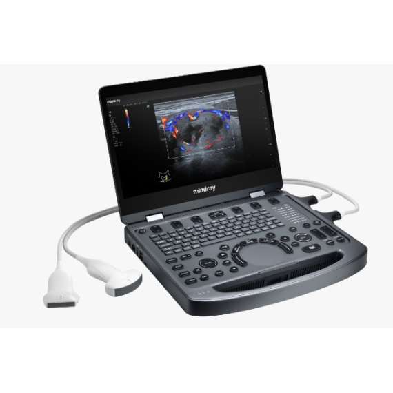Mindray MX3 Compact Ultrasound System, 2 image