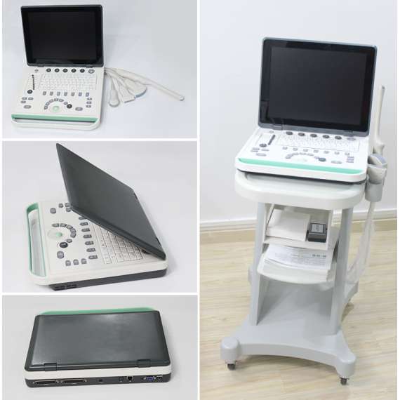 Sonostar SS-8 Laptop Ultrasound Scanner