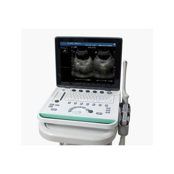 Sonostar SS-8 Laptop Ultrasound Scanner, 3 image